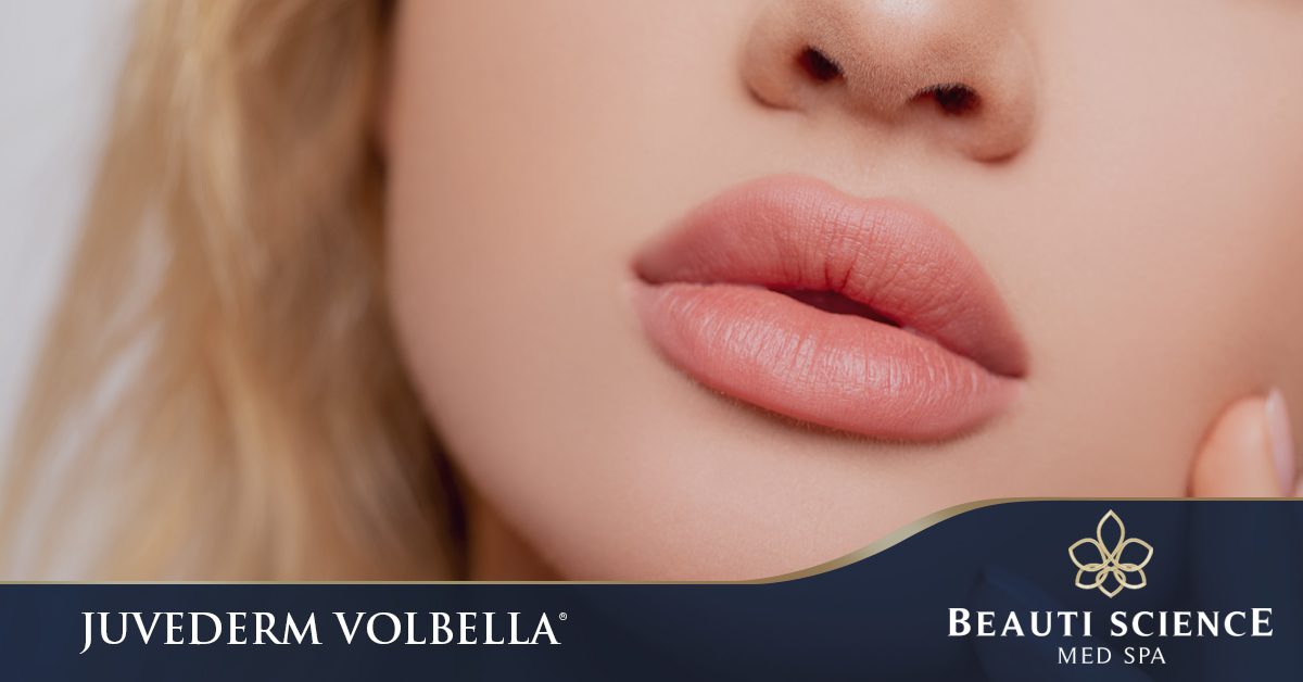 Juvederm Volbella Cosmetic Lip Filler in Plano